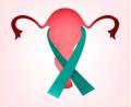 Неороговевающий рак шейки матки